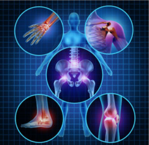 Multifactorial-causes-pain-image
