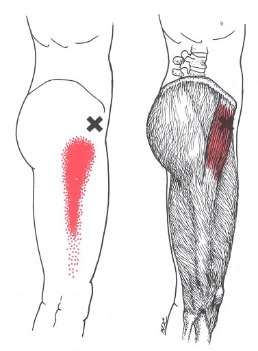 TFL Trigger Point Location