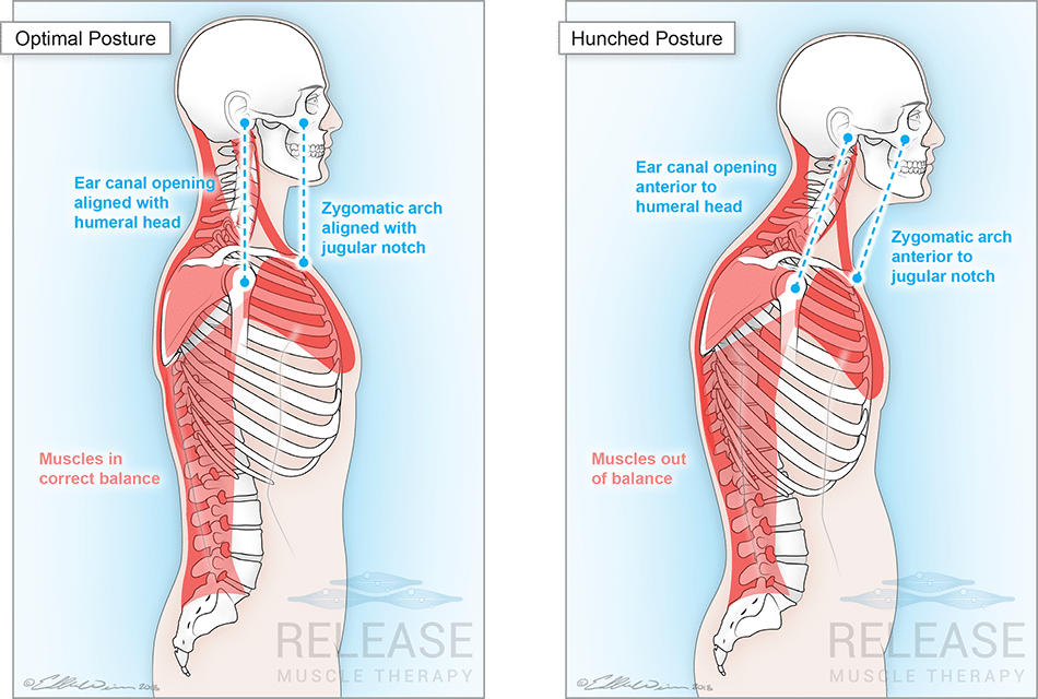 posture hacking
